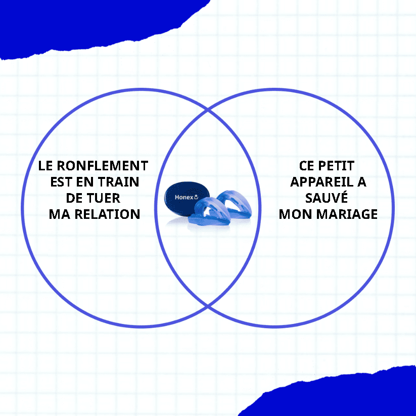 L’embout buccal anti-ronflement silencieux – Taille universelle