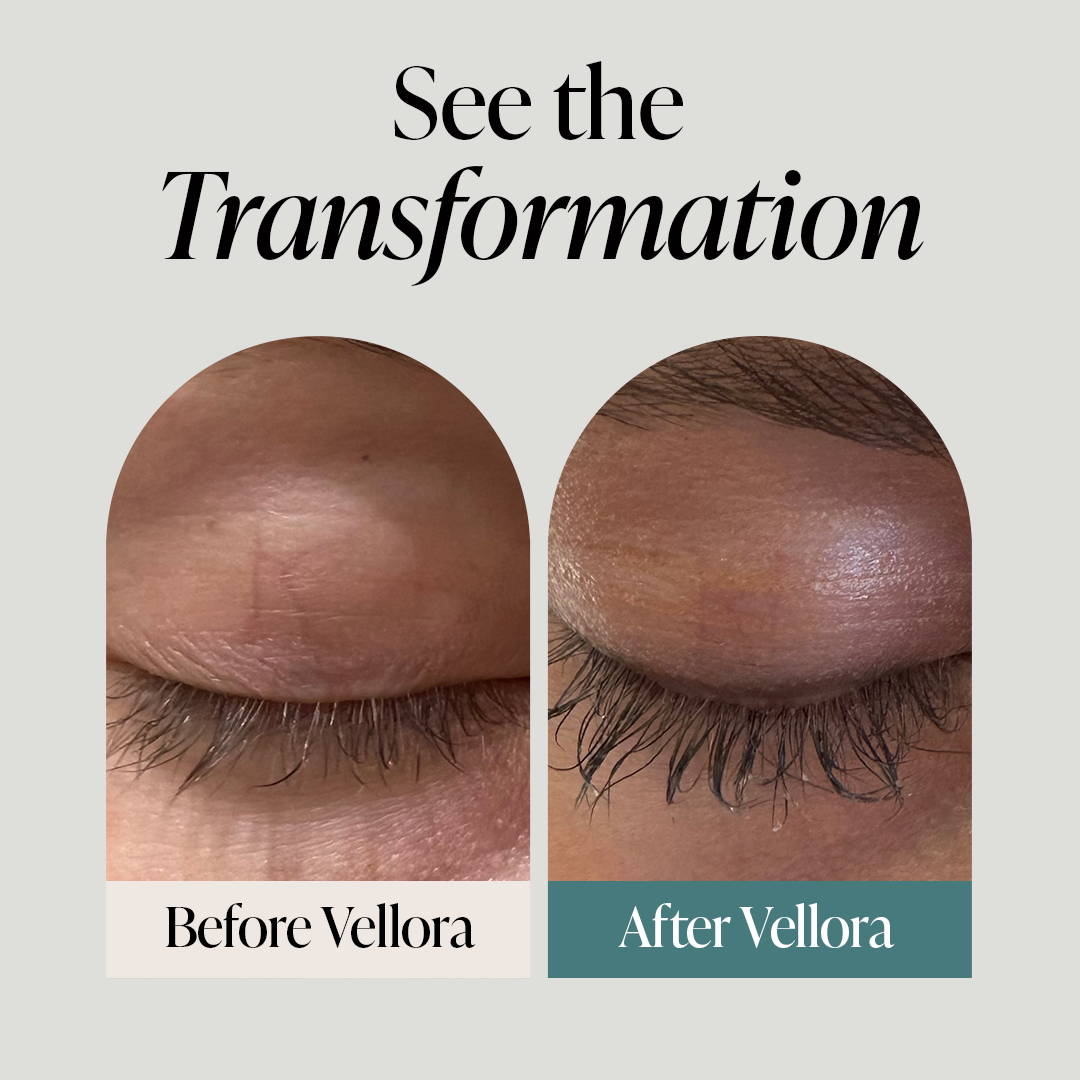 Vellora Lash Serum
